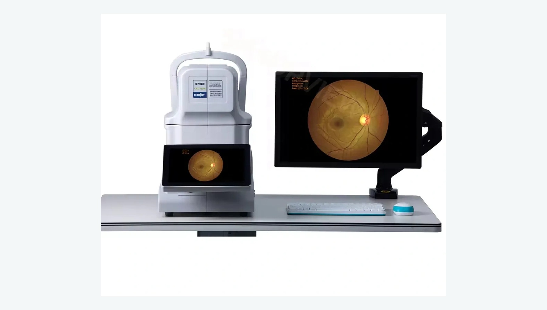 Fundus Camera